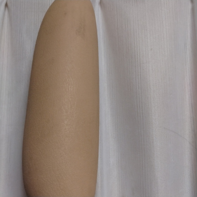 【Bランク 中古 手すり】モルテン バディー1 MNTCMIS (I型ストッパー