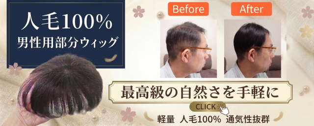 男性部分ウィッグ
