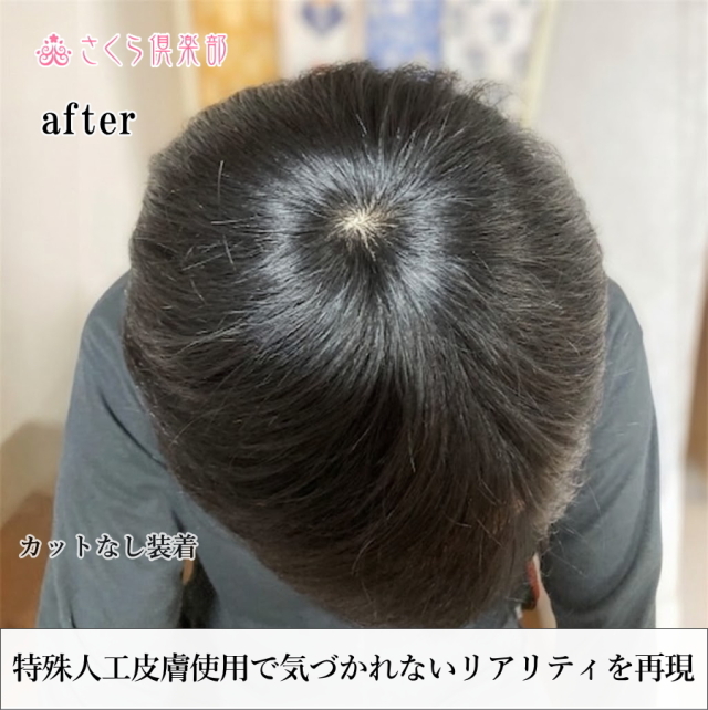 メンズフルウィッグ 男性用 全かつら 人毛100％ 機械植え製 MM300 お肌