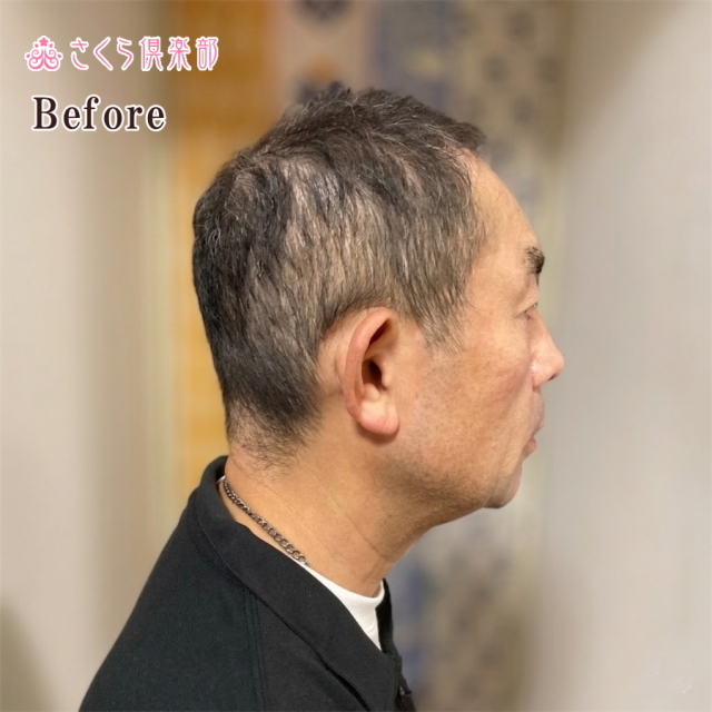 メンズフルウィッグ 男性用 全かつら 人毛100％ 機械植え製 MM300 お肌