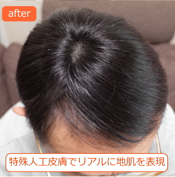 男性用メンズ部分ウィッグ自然すぎる人毛100% 特殊人工皮膚付きSサイズ