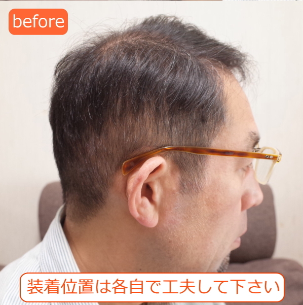 男性用メンズ部分ウィッグ自然すぎる人毛100% 特殊人工皮膚付きSサイズ