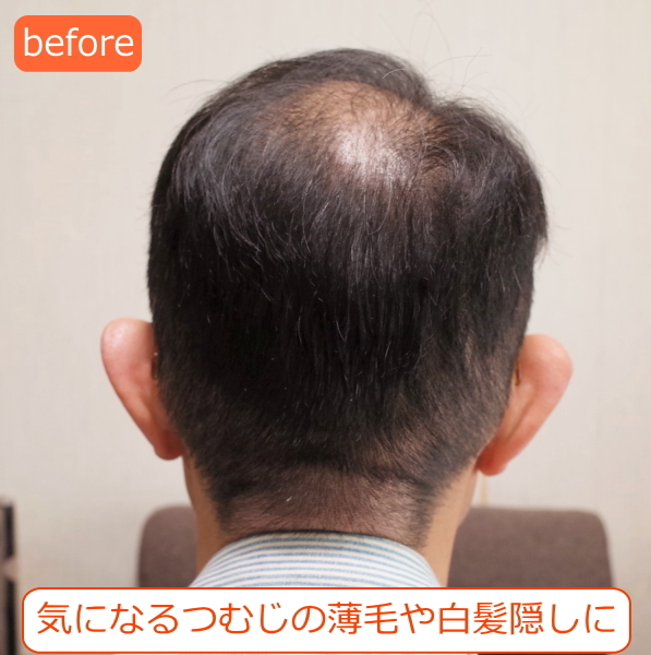 男性用メンズ部分ウィッグ自然すぎる人毛100% 特殊人工皮膚付きSサイズ