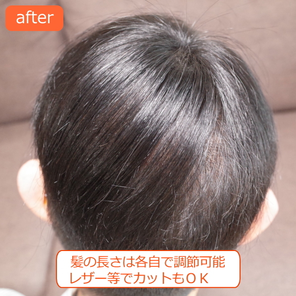 男性用メンズ部分ウィッグ自然すぎる人毛100% 特殊人工皮膚付きSサイズ 男性用メンズ部分ウィッグ自然すぎる人毛100% 特殊人工皮膚付きSサイズ