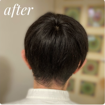 人毛100% 男性用部分ウィッグM. Lサイズ各種（top-300）ショートつむじ付き