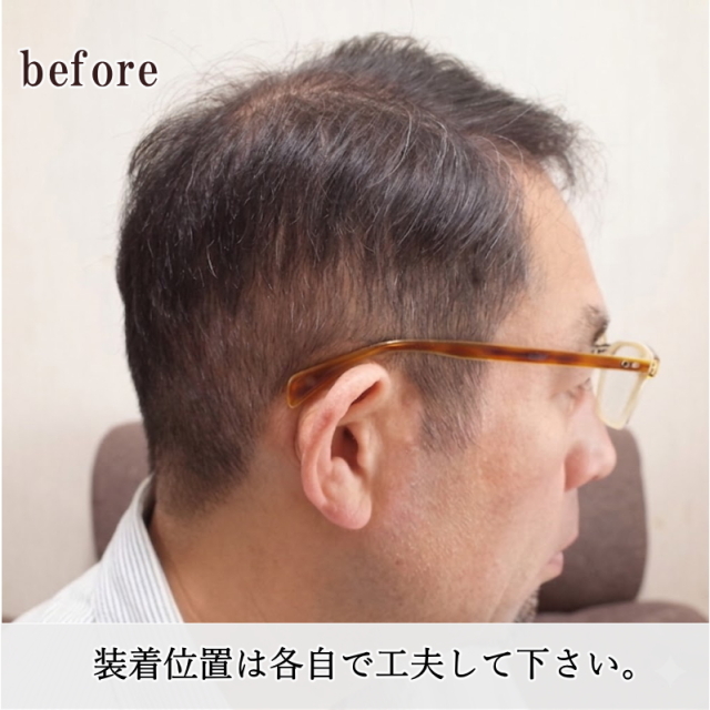 男性用メンズ部分ウィッグ自然すぎる人毛100% 特殊人工皮膚付きSサイズ