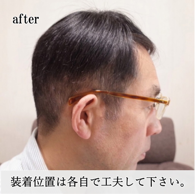 男性用メンズ部分ウィッグ自然すぎる人毛100% 特殊人工皮膚付きSサイズ