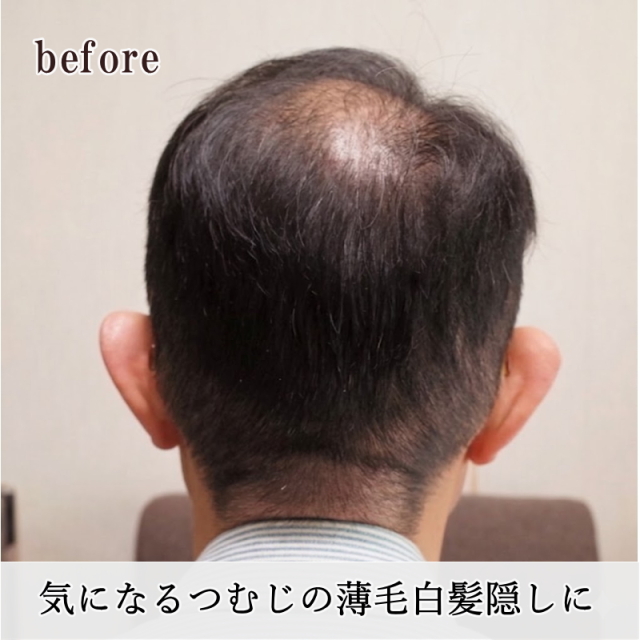 男性用メンズ部分ウィッグ自然すぎる人毛100% 特殊人工皮膚付きSサイズ