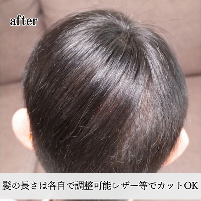 男性用メンズ部分ウィッグ自然すぎる人毛100% 特殊人工皮膚付きSサイズ