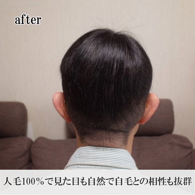 男性用メンズ部分ウィッグMサイズ 人毛100% 圧倒的な自然さで視線が気