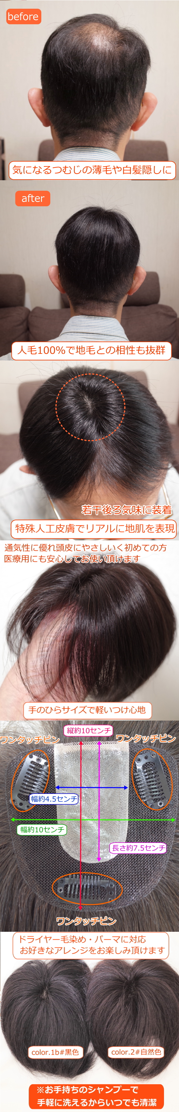 男性用メンズ部分ウィッグ人毛 かつら Mサイズ top-02n 医療用にも最適