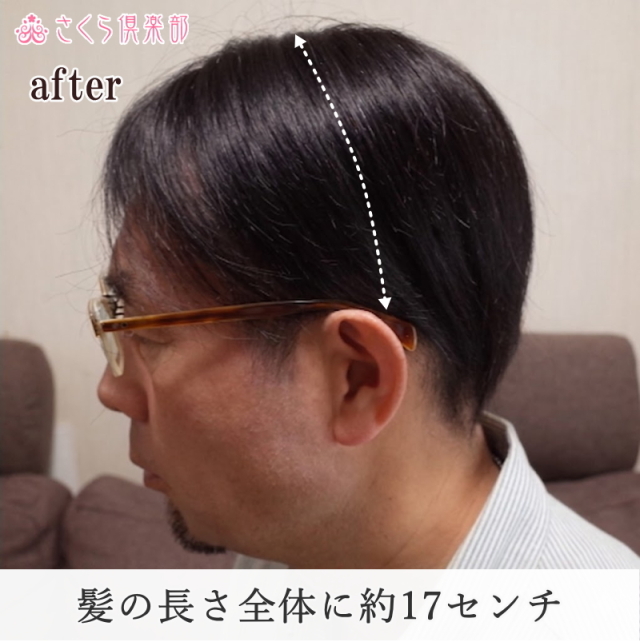人毛100% 男性用部分ウィッグ Lサイズ（top-07）センター分け地肌付き