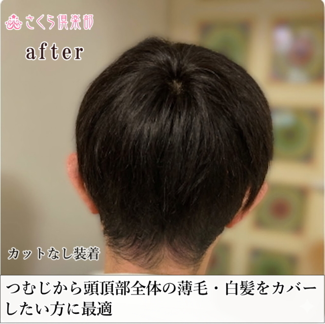 人毛100% 男性用部分ウィッグM. Lサイズ各種（top-300）ショートつむじ付き