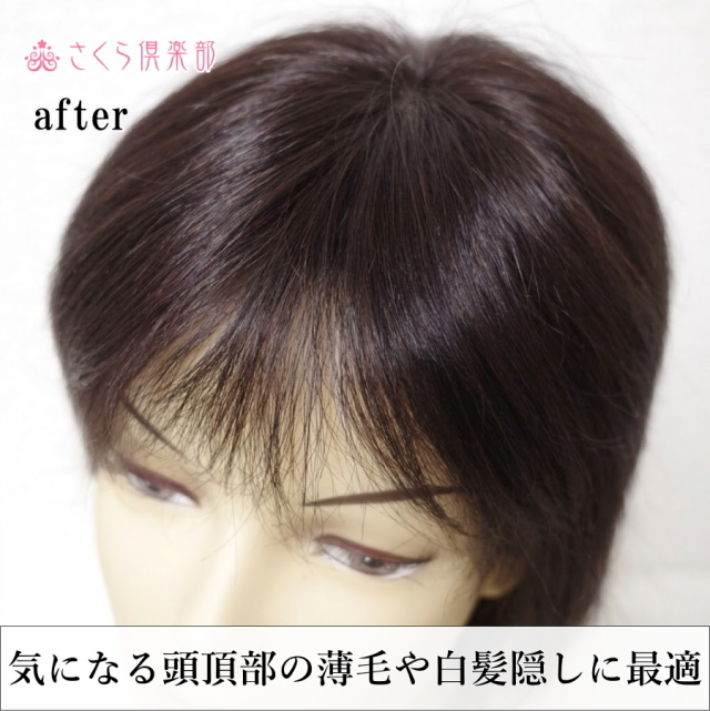 部分ウィッグ 女性用 つむじ 白髪隠し Sサイズ top-s｜人毛100総手植え