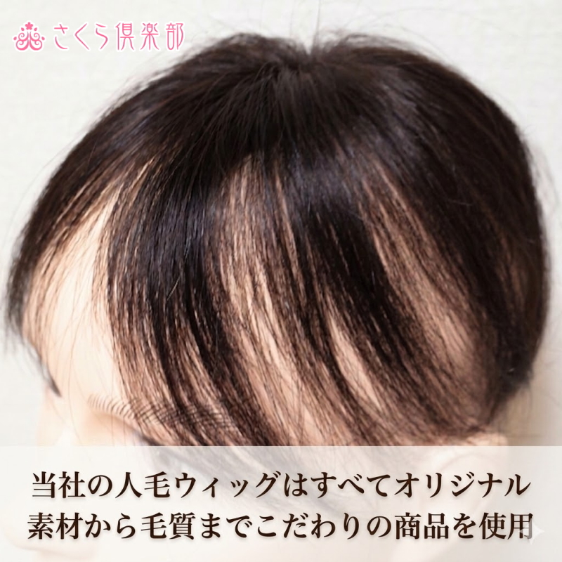 男性用メンズ部分ウィッグ人毛 100％ 自然で気付かれにくい極小Sサイズ top-s 医療用にも最適