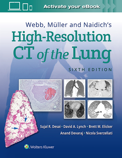 WEBB, MULLER & NAIDICH'S HIGH RESOLUTION CT OF LUNG, 6TH ED.