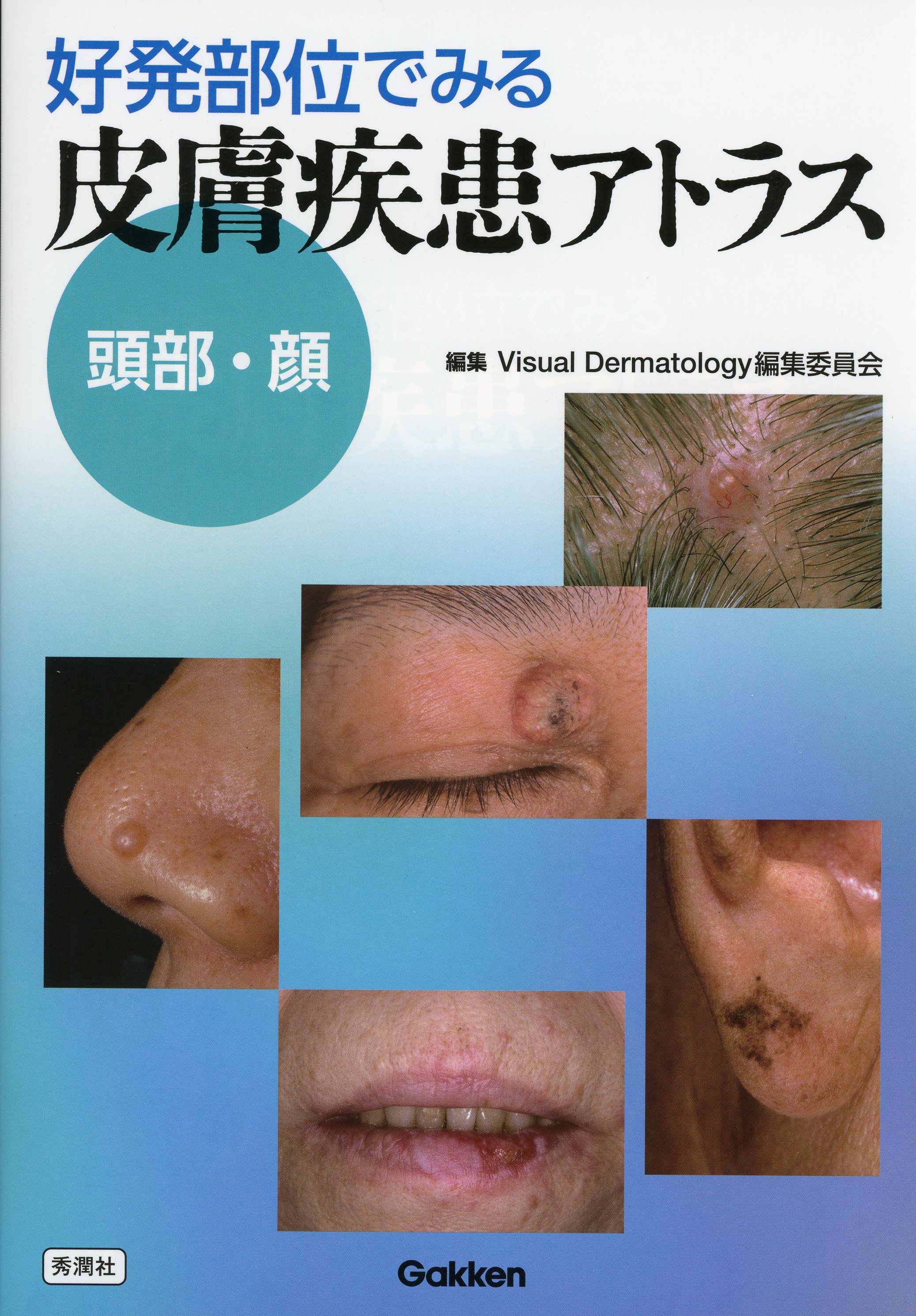 好発部位でみる皮膚疾患アトラス　頭部・顔