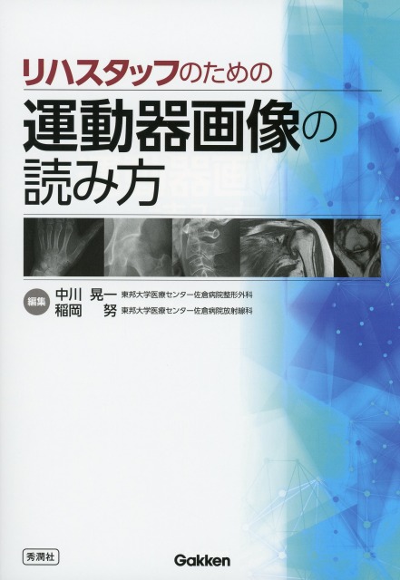 リハスタッフのための運動器画像の読み方