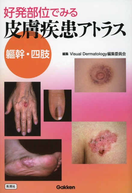 好発部位でみる皮膚疾患アトラス　躯幹・四肢