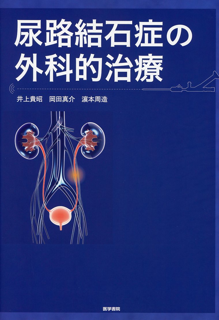 尿路結石症の外科的治療