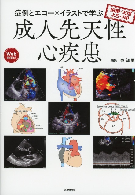 国循・天理よろづ印　症例とエコー×イラストで学ぶ成人先天性心疾患［Web動画付］