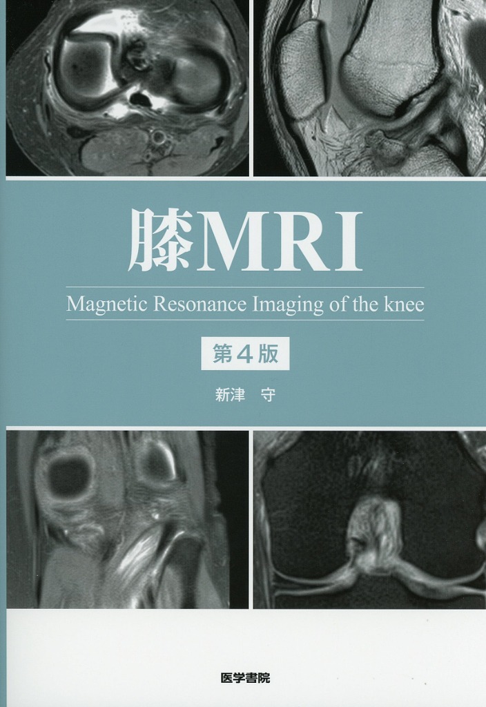 膝MRI　第4版