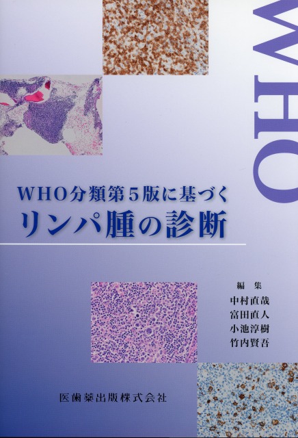 WHO分類第5版に基づくリンパ腫の診断