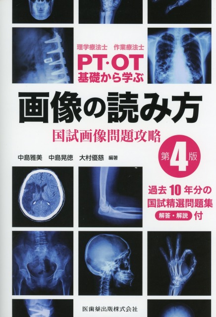 理学療法士・作業療法士　PT・OT　基礎から学ぶ　画像の読み方　第4版　国試画像問題攻略