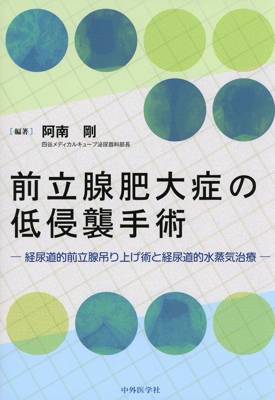 前立腺肥大症の低侵襲手術　―経尿道的前立腺吊り上げ術と経尿道的水蒸気治療―