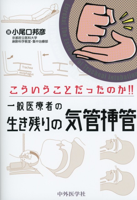 こういうことだったのか！！　一般医療者の生き残りの気管挿管