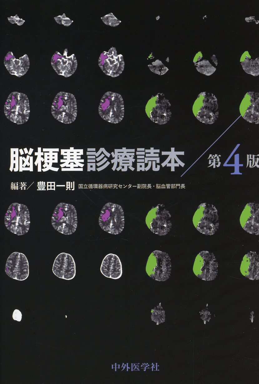 脳梗塞診療読本 第4版