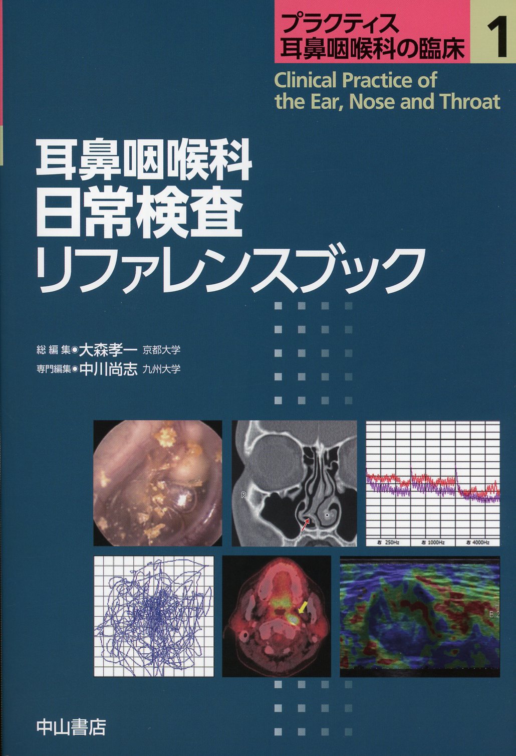 プラクティス耳鼻咽喉科の臨床　1　耳鼻咽喉科　日常検査リファレンスブック
