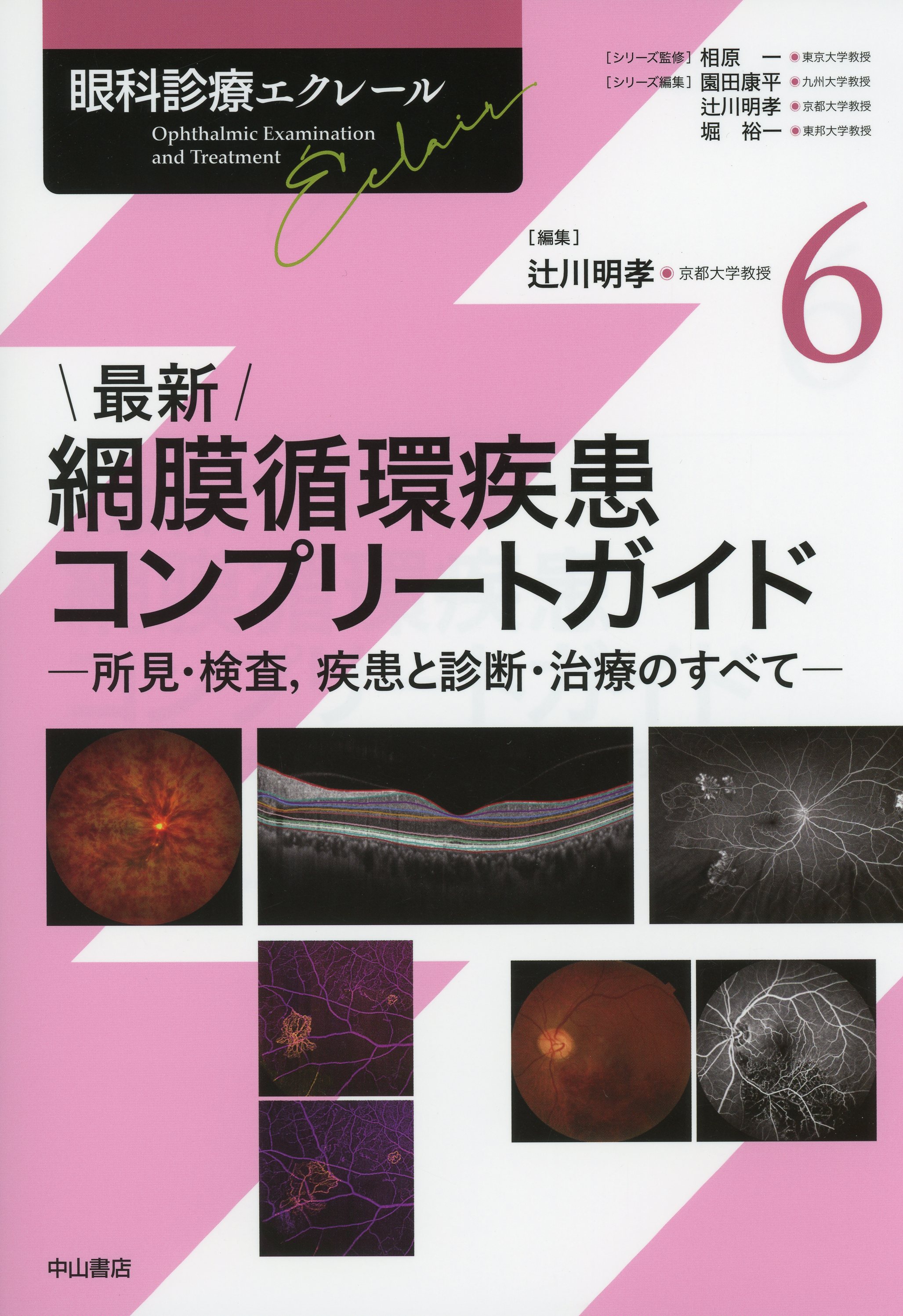 最新 網膜循環疾患コンプリートガイド－所見・検査，疾患と診断・治療のすべて