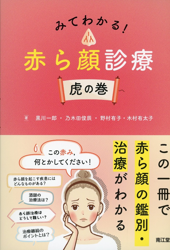 みてわかる！　赤ら顔診療　虎の巻