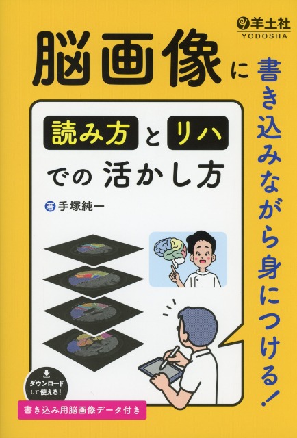 脳画像に書き込みながら身につける！　読み方とリハでの活かし方