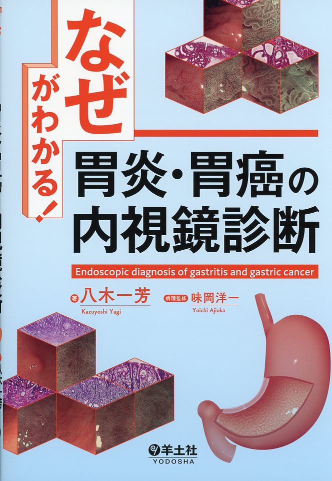 「なぜ」がわかる！胃炎・胃癌の内視鏡診断