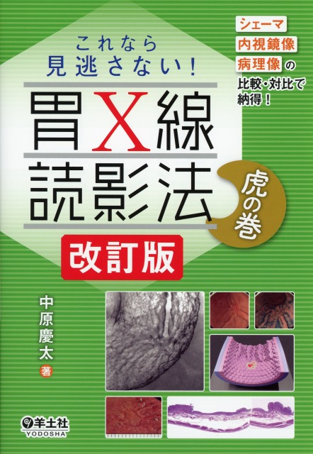 これなら見逃さない！胃X線読影法　虎の巻　改訂版