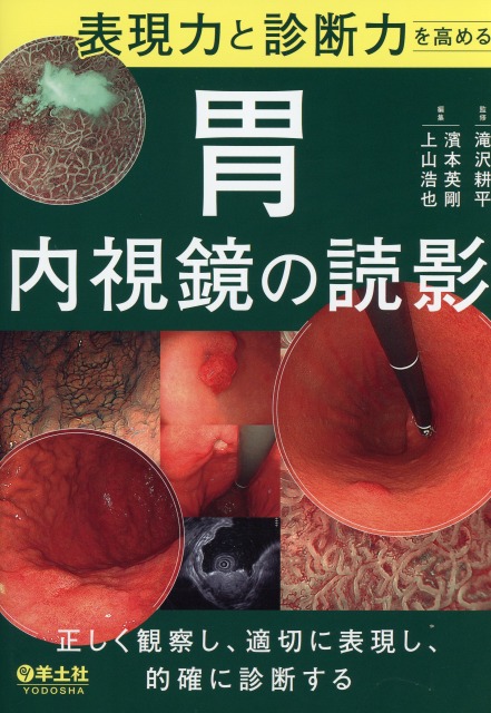表現力と診断力を高める　胃内視鏡の読影