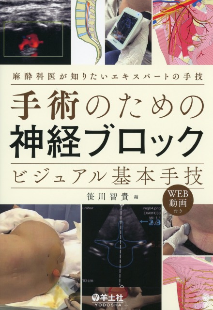 手術のための神経ブロック　ビジュアル基本手技