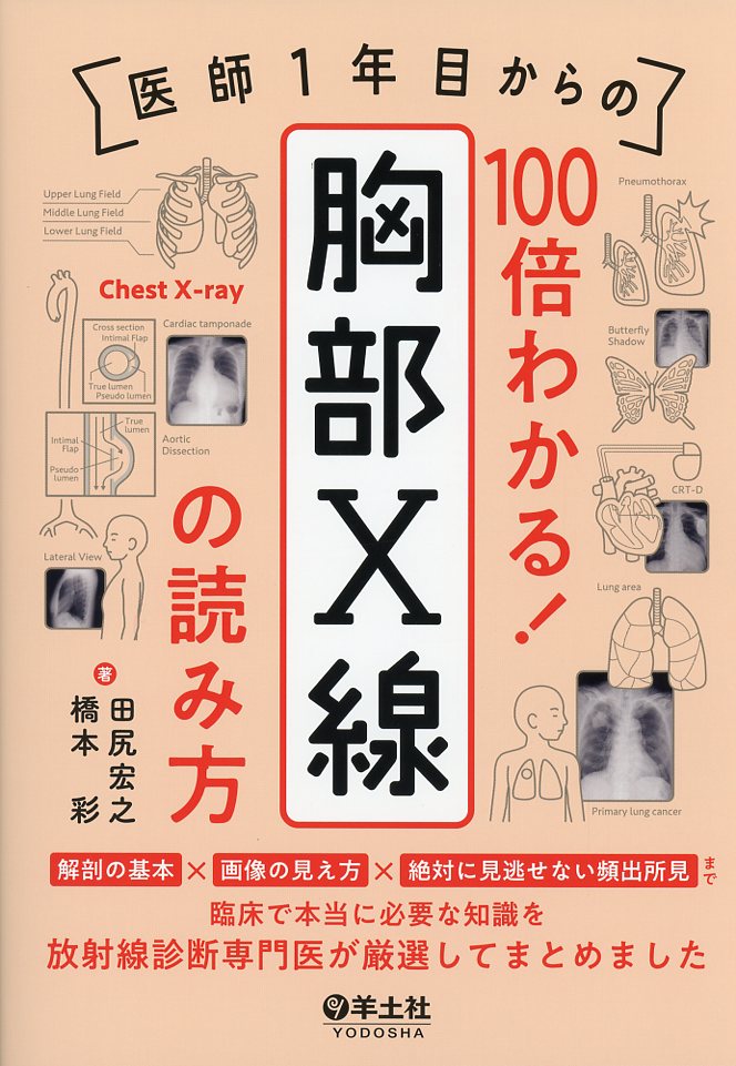 医師1年目からの　100倍わかる！　胸部X線の読み方