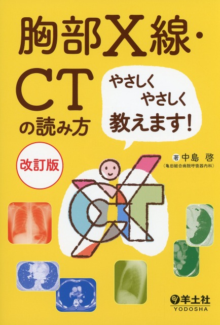 胸部X線・CTの読み方やさしくやさしく教えます！　改訂版