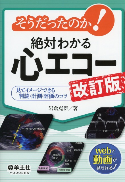 そうだったのか！　絶対わかる心エコー　改訂版