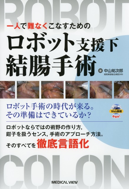ロボット支援下結腸手術