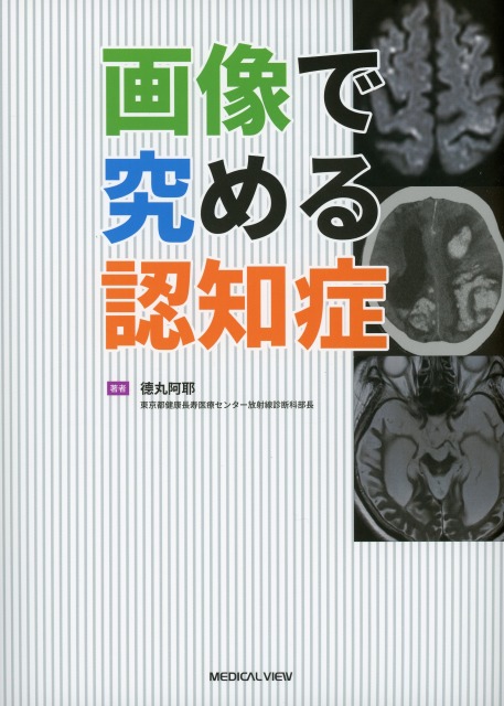 画像で究める認知症