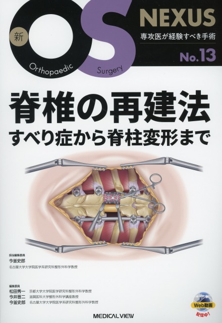 新OS NEXUS　No.13　脊椎の再建法　すべり症から脊柱変形まで
