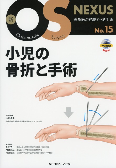 新OS NEXUS　No.15　小児の骨折と手術