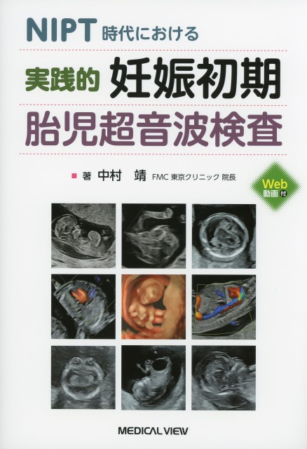 NIPT時代における　実践的　妊娠初期胎児超音波検査