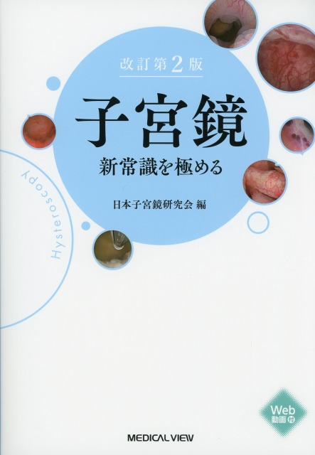 改訂第2版　子宮鏡　新常識を極める
