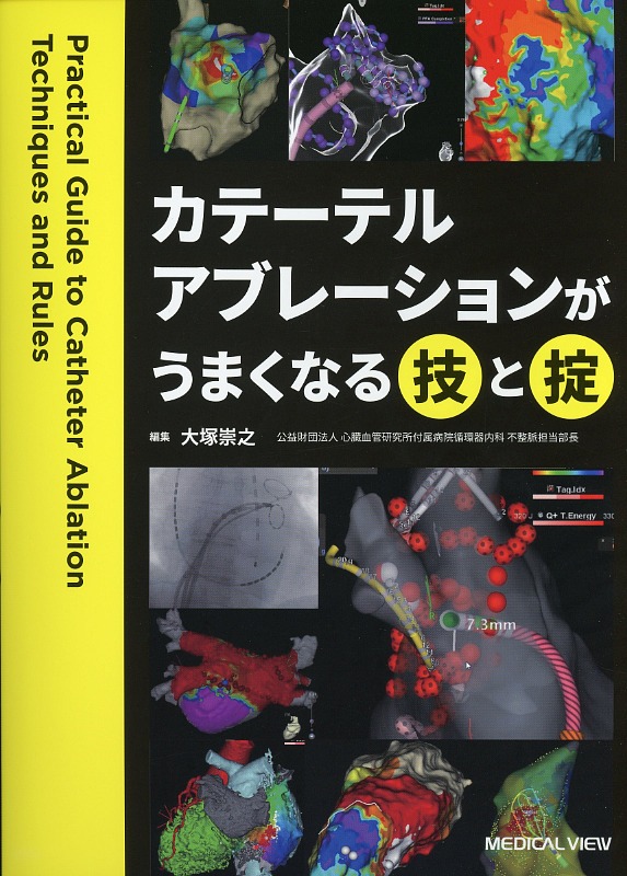 カテーテルアブレーションがうまくなる技と掟