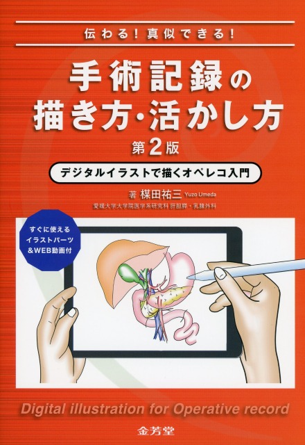 伝わる！　真似できる！　手術記録の描き方・活かし方　第2版